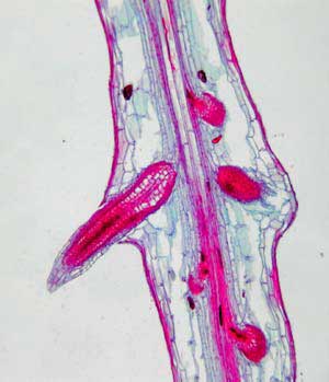 Root Formation